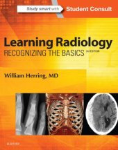 book Learning radiology: recognizing the basics