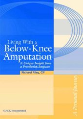 book Living with a Below-Knee Amputation: A Unique Insight from a Prosthetist/Amputee