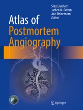 book Atlas of Postmortem Angiography