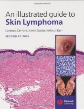 book An Illustrated Guide to Skin Lymphoma