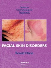 book Facial Skin Disorders