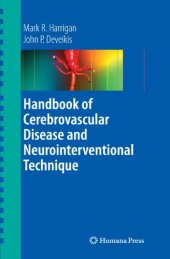 book Handbook of Cerebrovascular Disease and Neurointerventional Technique