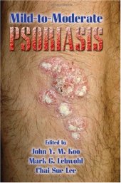 book Mild-to-Moderate Psoriasis