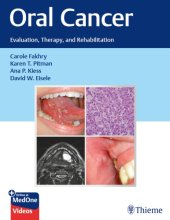 book Oral Cancer: Evaluation, Therapy, and Rehabilitation