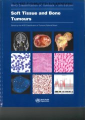 book WHO Classification of Soft Tissue and Bone Tumours