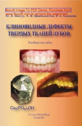 book Клиновидные дефекты твердых тканей зубов