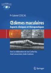 book Œdèmes maculaires: Aspects cliniques et thérapeutiques