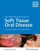 book The ADA Practical Guide to Soft Tissue Oral Disease