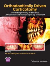 book Orthodontically driven corticotomy: tissue engineering to enhance orthodontic and multidisciplinary treatment