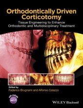 book Orthodontically driven corticotomy: tissue engineering to enhance orthodontic and multidisciplinary treatment