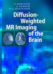 book Diffusion-Weighted MR Imaging of the Brain