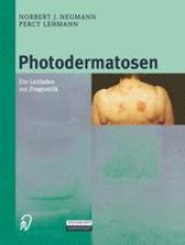 book Photodermatosen: Ein Leitfaden zur Diagnostik