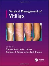 book Surgical Management of Vitiligo