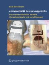 book Endoprothetik des Sprunggelenks: Historischer Überblick, aktuelle Therapiekonzepte und Entwicklungen