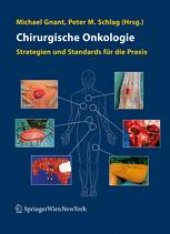 book Chirurgische Onkologie: Strategien und Standards für die Praxis