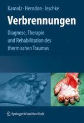 book Verbrennungen: Diagnose, Therapie und Rehabilitation des thermischen Traumas