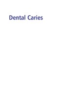 book Dental Caries: the Disease and Its Clinical Management