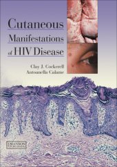 book Cutaneous Manifestations of HIV Disease