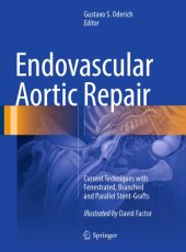 book Endovascular Aortic Repair Current Techniques with Fenestrated, Branched and Parallel Stent-Grafts