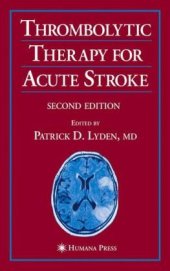 book Thrombolytic Therapy for Acute Stroke