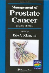 book Management of Prostate Cancer