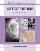 book Osteoporosis: An Atlas Of Investigation And Diagnosis