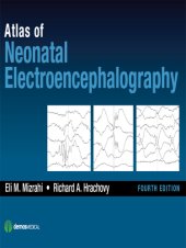 book Atlas of Neonatal Electroencephalography