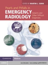 book Pearls and pitfalls in emergency radiology: variants and other difficult diagnoses