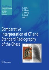 book Comparative Interpretation of CT and Standard Radiography of the Chest