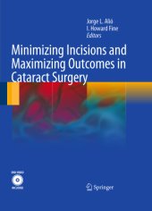 book Minimizing Incisions and Maximizing Outcomes in Cataract Surgery