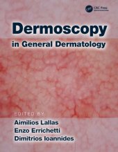 book Dermoscopy in general dermatology