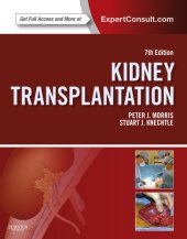 book Kidney transplantation: principles and practice