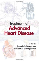 book Treatment of Advanced Heart Disease