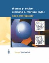 book Knee Arthroplasty