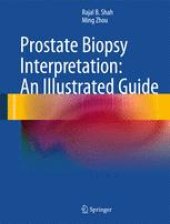 book Prostate Biopsy Interpretation: An Illustrated Guide