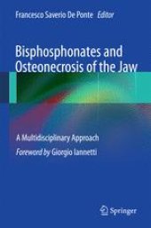 book Bisphosphonates and Osteonecrosis of the Jaw: A Multidisciplinary Approach