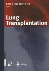 book Lung Transplantation