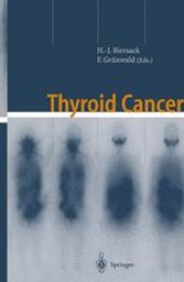 book Thyroid Cancer