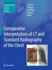 book Comparative Interpretation of CT and Standard Radiography of the Chest