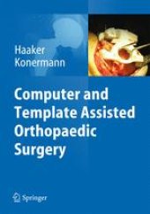 book Computer and Template Assisted Orthopedic Surgery