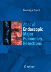 book Atlas of Endoscopic Major Pulmonary Resections