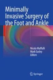 book Minimally Invasive Surgery of the Foot and Ankle