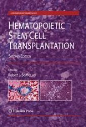 book Hematopoietic Stem Cell Transplantation