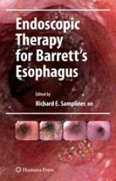 book Endoscopic Therapy for Barrett's Esophagus