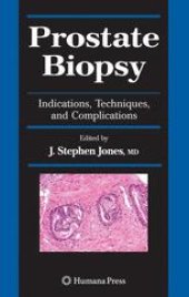 book Prostate Biopsy: Indications, Techniques, and Complications