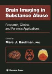 book Brain Imaging in Substance Abuse: Research, Clinical, and Forensic Applications