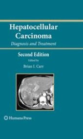 book Hepatocellular Carcinoma: Diagnosis and Treatment