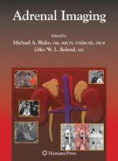 book Adrenal Imaging