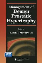 book Management of Benign Prostatic Hypertrophy