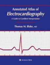 book Annotated Atlas of Electrocardiography: A Guide to Confident Interpretation